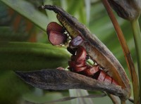 Dientes flojos