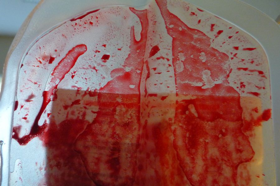 "Pulmones de Sangre" de Pablo Weisbek