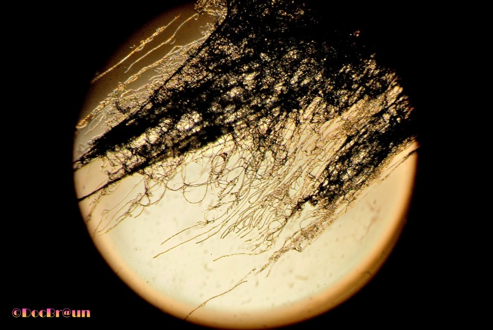 "Aspergillus Niger a 10X" de Juan Jos Braun